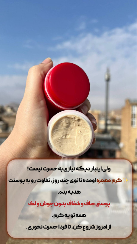 کرم روشن کننده وضدلک شب 25 گرمی اصل