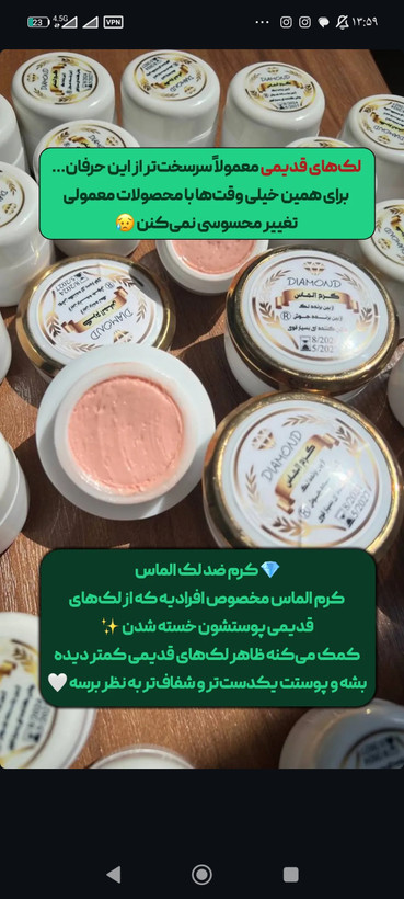 کرم ضدلک وروشن کننده قوی الماس20 گرم